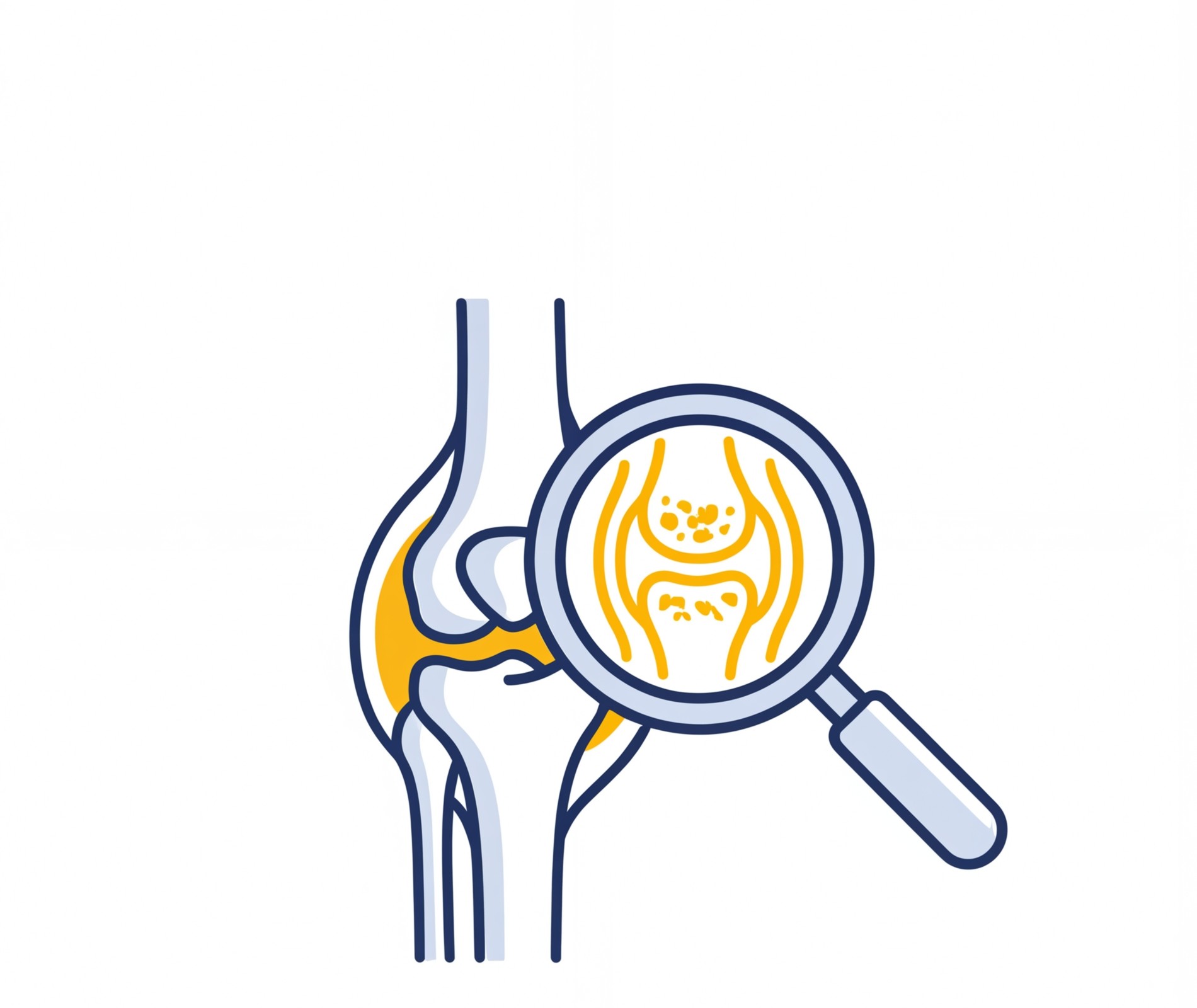 Understand your joint