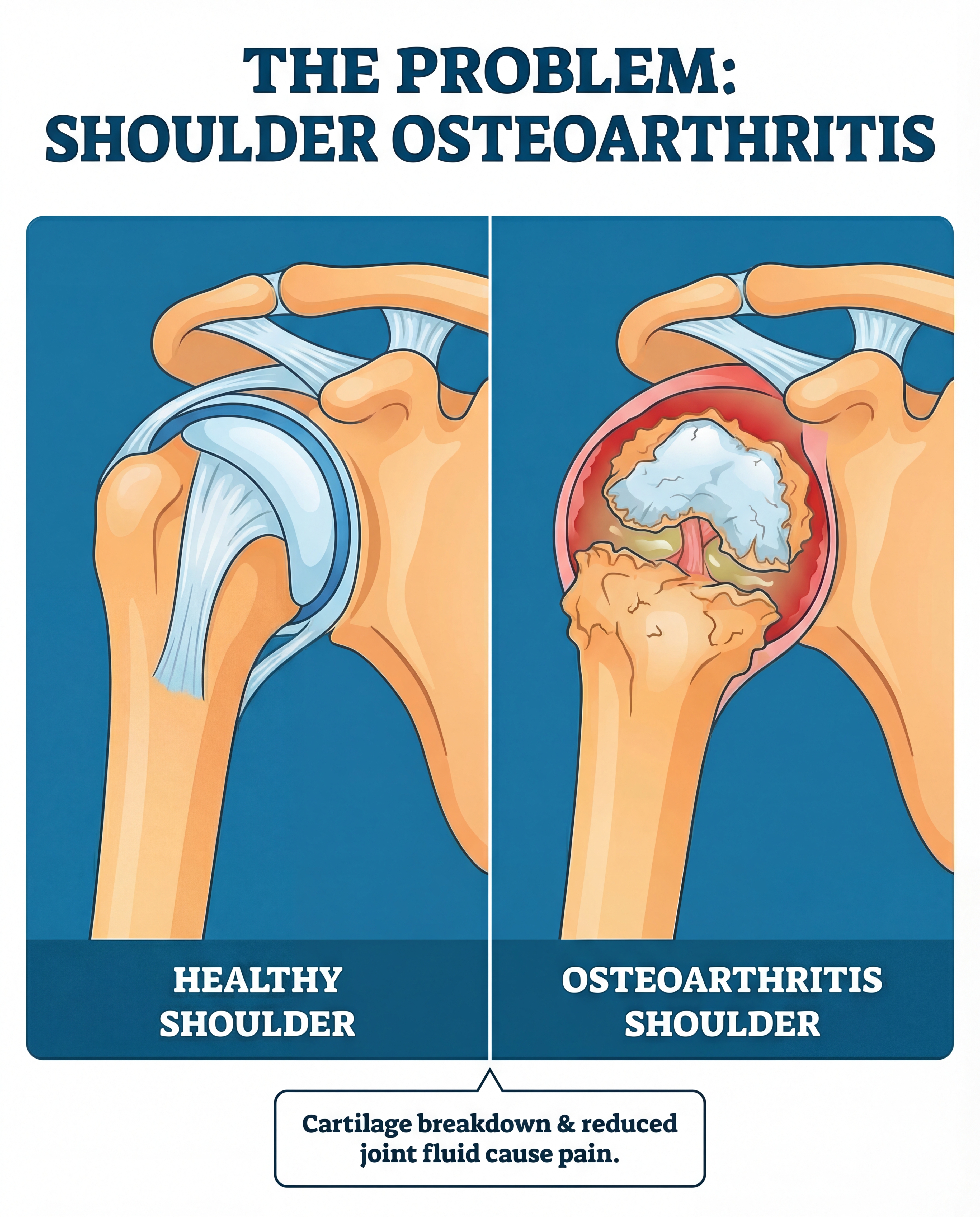 Patient consultation before shoulder treatment
